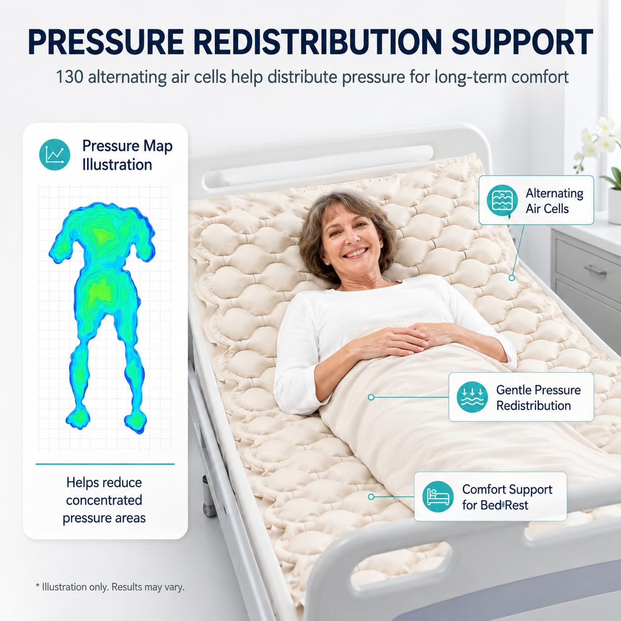 Alternating Air Pressure Mattress Pad, Bed Sore Prevention, Bed Mattress Topper with Quiet Pump & Waterproof, Relief Ulcer, Suitable for Bedridden or Limited Mobility Patie